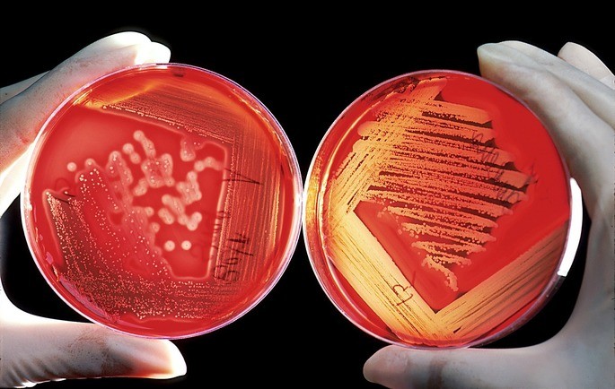 placas de petri con colonias de bacterias