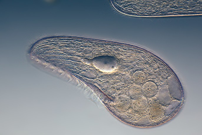 The protozoan Blepharisma japonicum