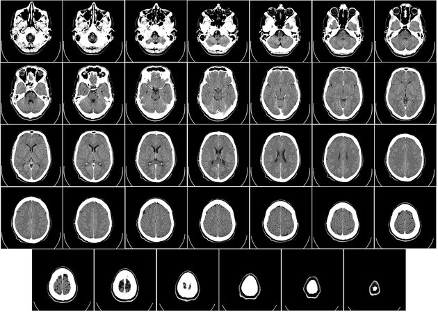 psiquiatria y psicología