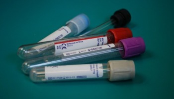 Diferencia entre suero y plasma