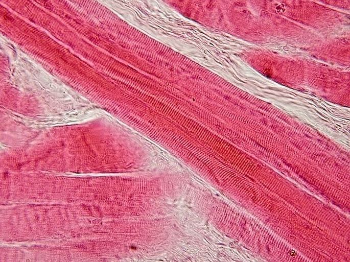 skeletal muscle cell type