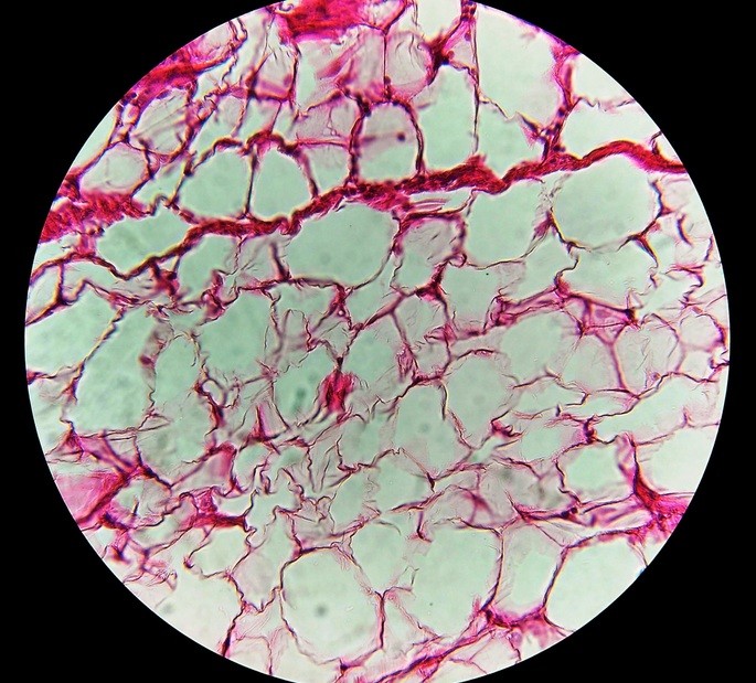adipocito tipos de celulas